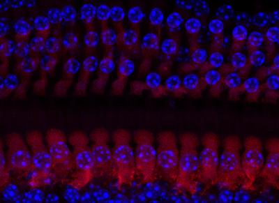 Mice Reveal 38 New Genes Involved In Hearing Loss