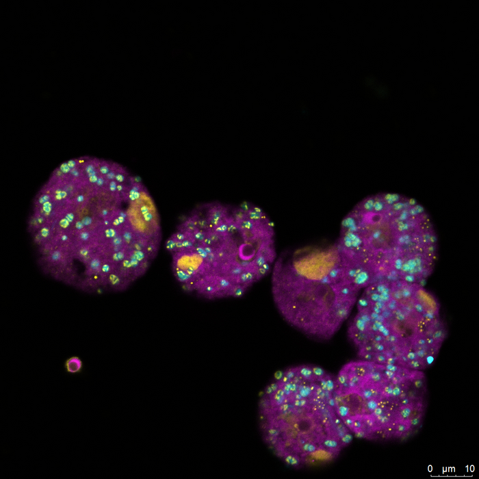 The FISH image - FISH stands for a visualisation method called fluorescence in situ hybridisation - shows amoebae infected simultaneously with the Viennavirus (for the first time isolated in this study and therefore named by the research team) and the bacterial symbiont. In the image, the amoebae are shown in magenta, their symbionts in cyan and DNA in yellow. The larger yellow structures are the virus factories, which are still in the initial phase here and cannot produce infectious viruses.