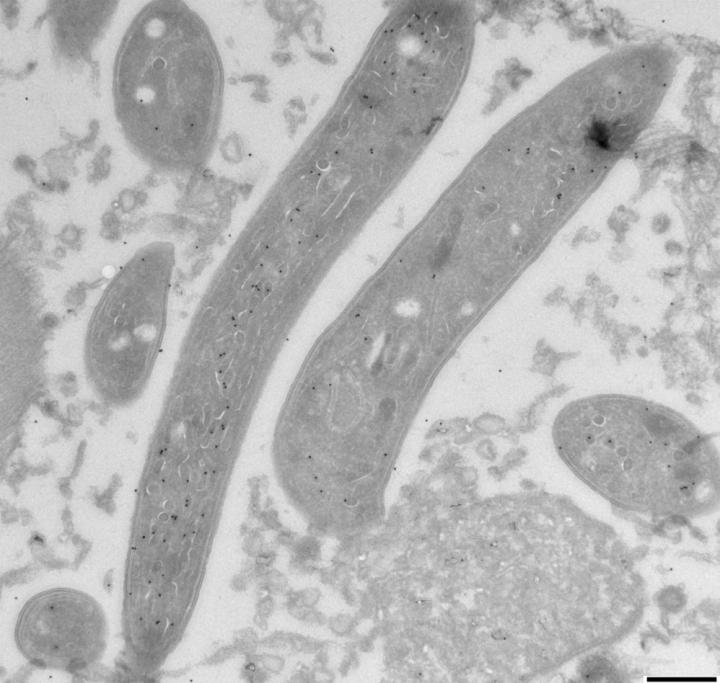 Electron Microscopy Of Sporozoites With EXP2 Labeling.