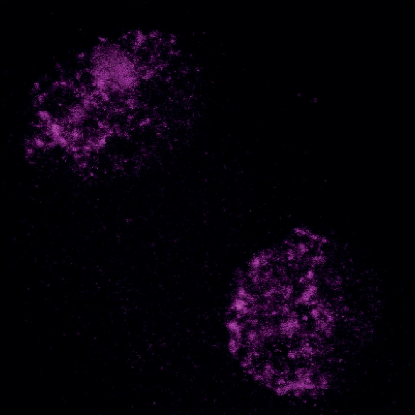 Heterochromatin