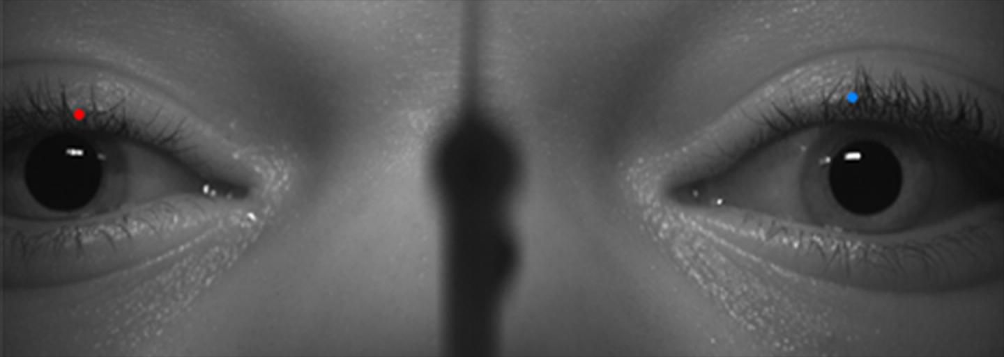 Tracking Eyelid Position During a Stimulated Blink using Image Processing