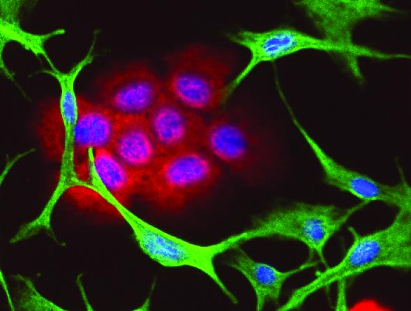 Melanomas Manipulate Their Environment 5 Of EurekAlert