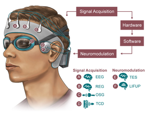 BRAIN 1