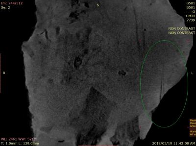 Scan of Parts of Skeleton Embedded in Rock