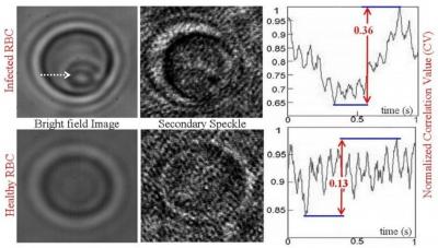 Secondary Speckle Sensing Microscopy