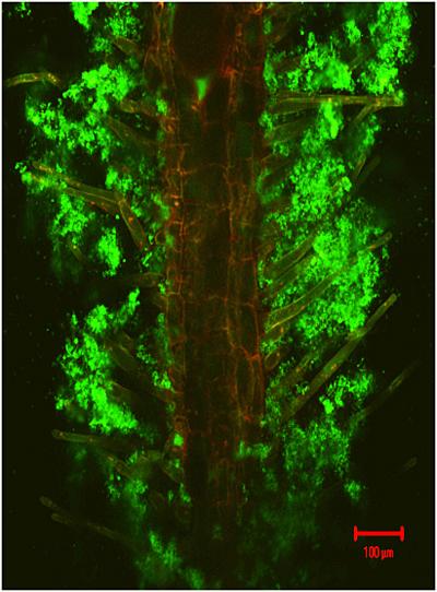 Plant Under Attack Signals Beneficial Bacteria to Help