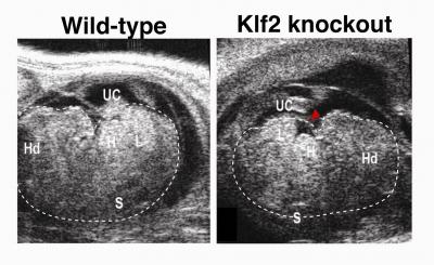 How Blood Flow Dictates Gene Expression