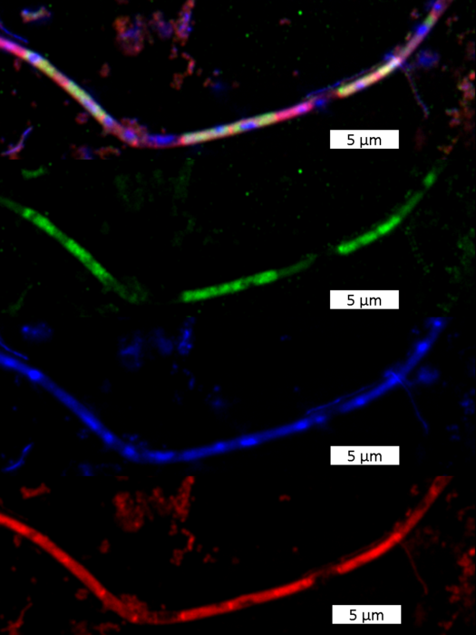 Fluoreszenzmikroskopische Aufnahmen von Methanosaeta, einer filamentösen methanogenen Archaee.