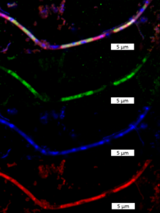 Methanosaeta, a filamentous methanogenic archaeon, in the fluorescence microscope