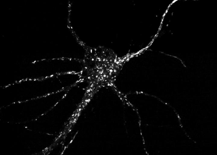 Kinesin Tagged Vesicles