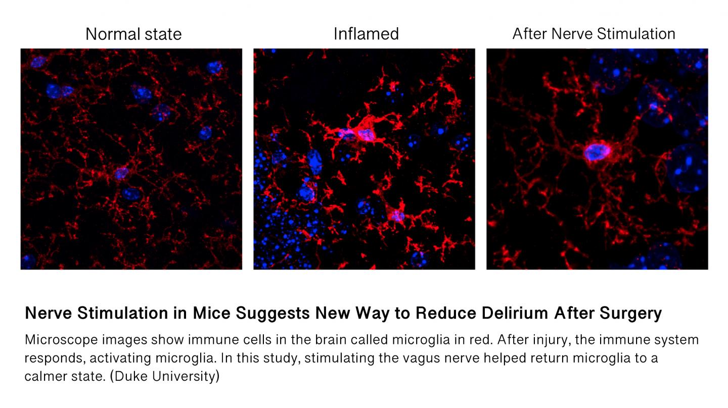 Nerve Stimulation in Mice Suggests New Way to Reduce Delirium After Surgery