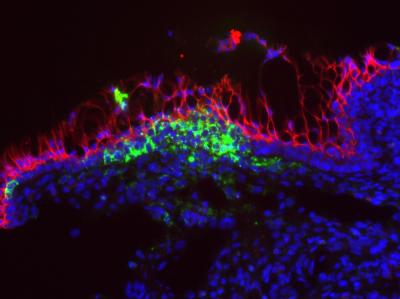 LCMV Virus in Vaginal Tissue