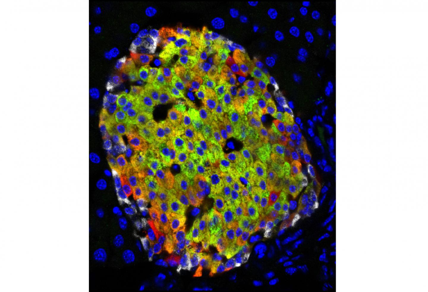 New Type of Insulin-Producing Cell Discovered