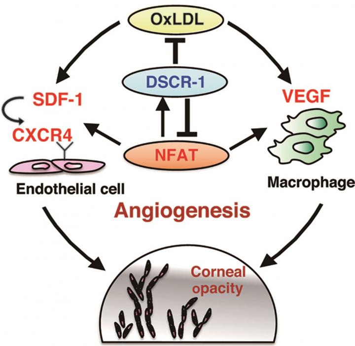 Schematic Diagram of Pathological Changes in Corneal Angiogenesis