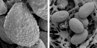 Large vs. Small Mucor Spores