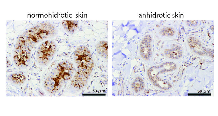 TRPV4 expression in human sweat glands.