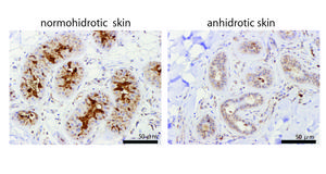 TRPV4 expression in human sweat glands.