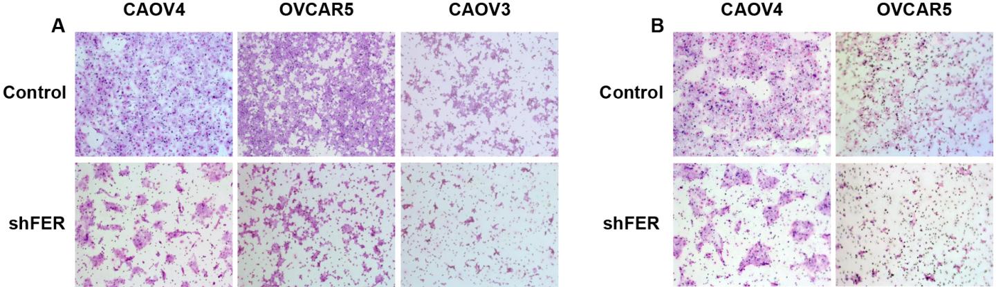 A New Pathway in Ovarian Cancer
