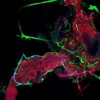 Nerve Cells in the Gut of the <I>Drosophila melanogaster</I> (2 of 3)