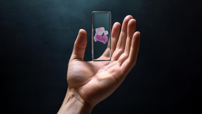 H&E-stained whole slide image of cancer tissue