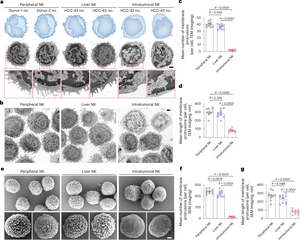 Tumors evade immune cytotoxicity by altering the surface topology of NK cells