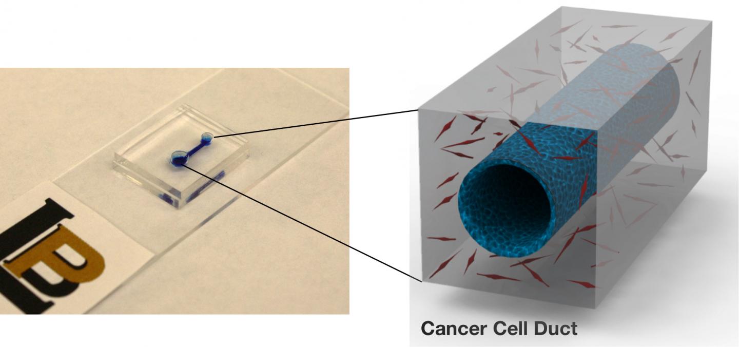 Pancreatic Cancer Simulation Device