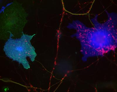 MDGA1 Suppresses Neuronal Synaptogenesis