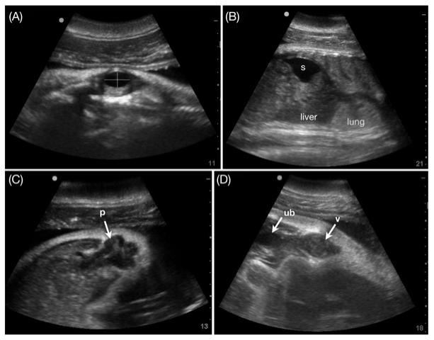 Ultrasound Images