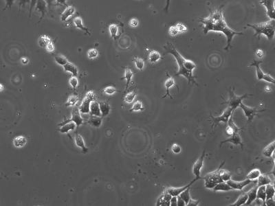 hES Cells on PDL Coating With Y27632