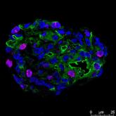 Human Thyroid Organoid