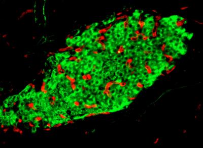 Molecule Important in Development of the Pancreas