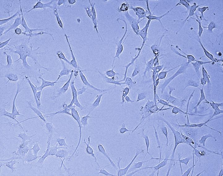 Glioblastoma Cells