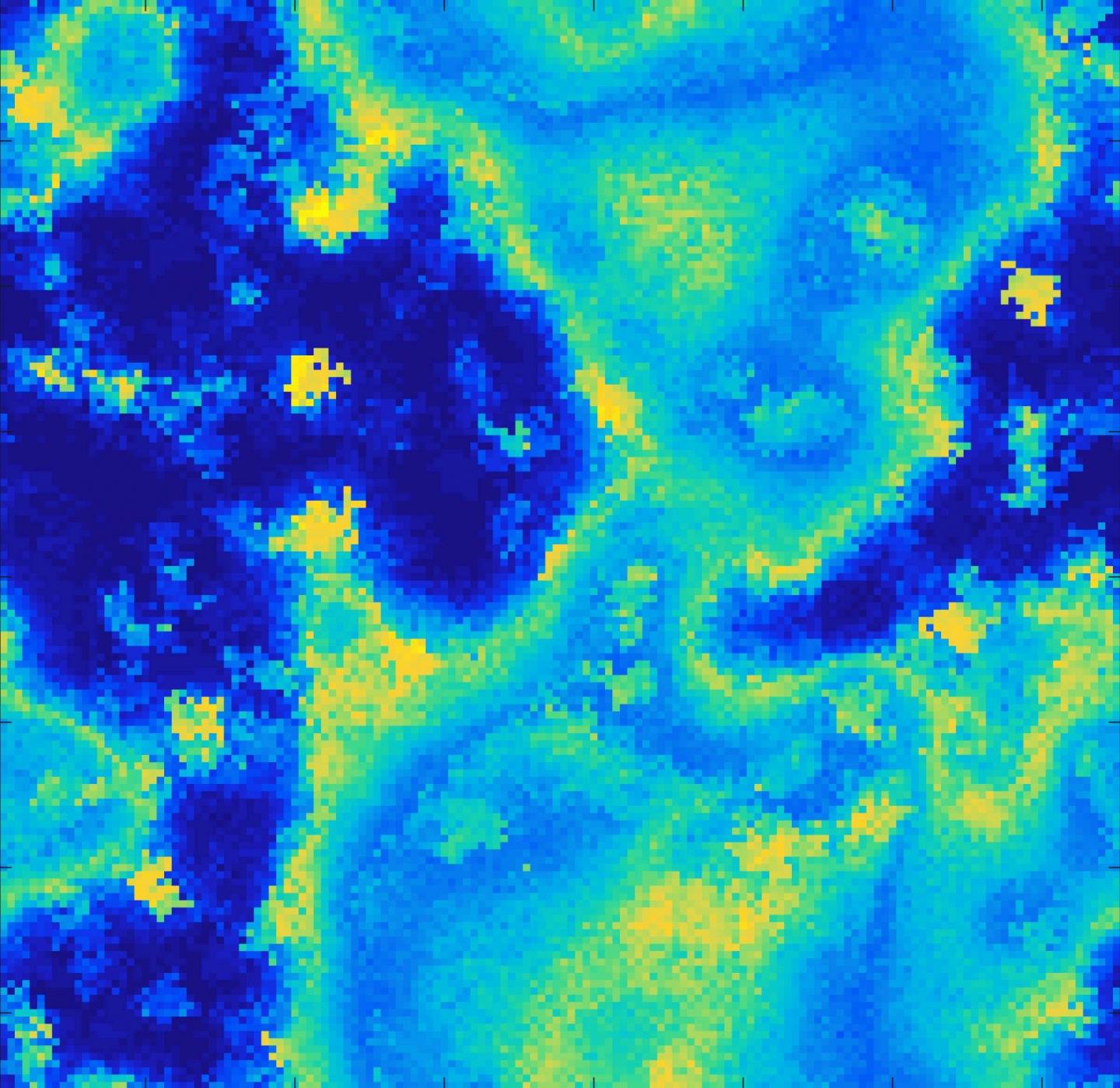 Brain Model Explores the Cause of Different Epileptic Seizure Onset Patterns