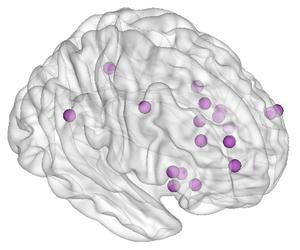 Salience network locations related to dementia's behavioral impacts