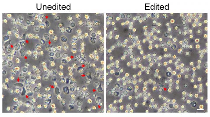 Red Blood Cells, Before And After