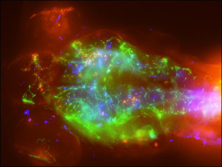 Zebrafish Larva Infected with Cryptococcal Meningitis (1 of 2)