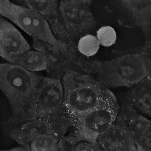 Small gold nanoparticles don't kill colon cancer cells