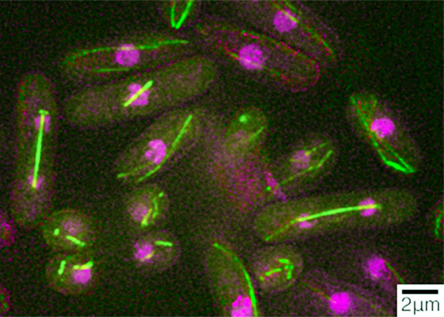 Fission Yeast Cells in the Process of Dividing