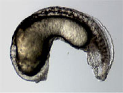 How Rare Bone Disease Progresses