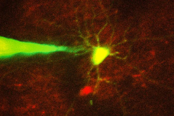 Robotic System Monitors Specific Neurons