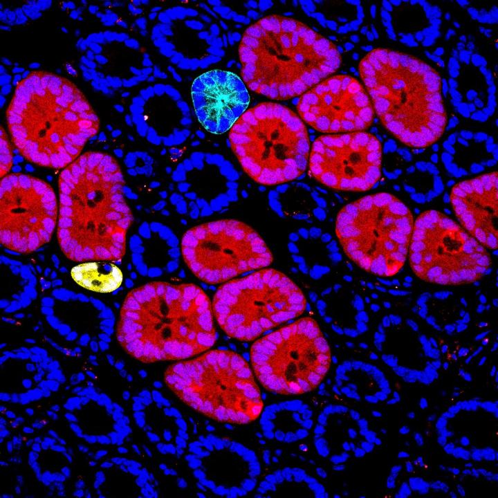 Red2Onco confocal microscopy