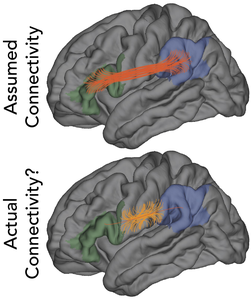 Distant regions of the human brain are wired together by surprisingly few connections