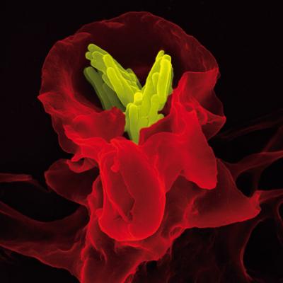 Immune System Tuberculosis