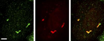 Fus Granules Translate RNA