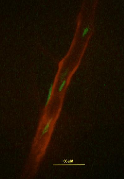 Real-Time Visualization of Lyme Disease