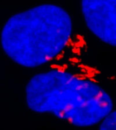 Stem Cells Poised to Self-Destruct for the Good of the Embryo