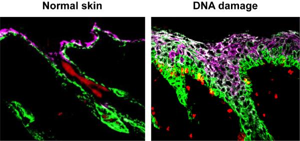 Skin Cells; Normal and DNA Damage