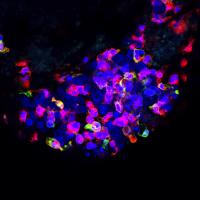 Studying Immune-Cancer Interactions in Zebrafish
