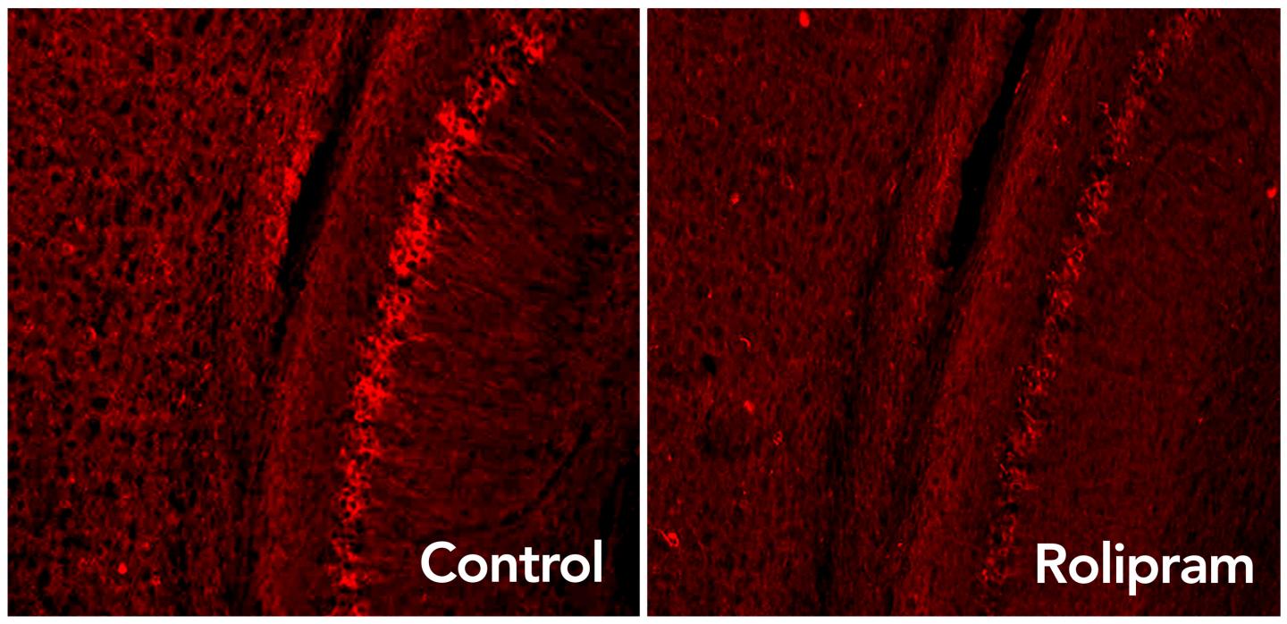 Images of Drug-Treated Alzheimer's Tissue