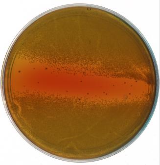 MRSA in Petri Dish